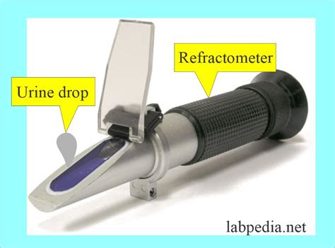 refractometer vs urinometer|specific gravity urine refractometer high.